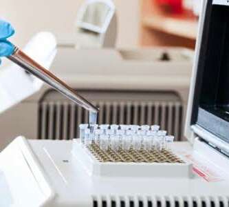 Gombe Govt PCR Machine