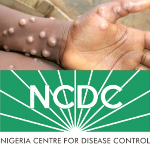 Monkeypox Virus NCDC Nigeria