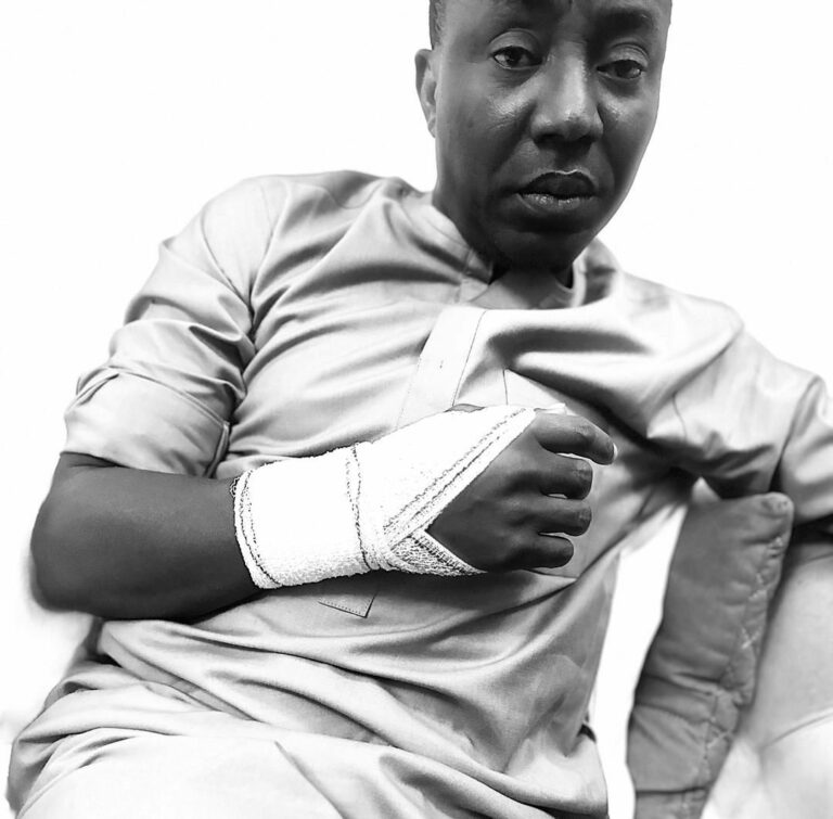 In a disturbing development early Thursday morning, detained activist and publisher Omoyele Sowore was allegedly suffered police brutality after he was assaulted by a police team during a forced transfer from his cell at the Force Intelligence Department (FID) in Abuja.
